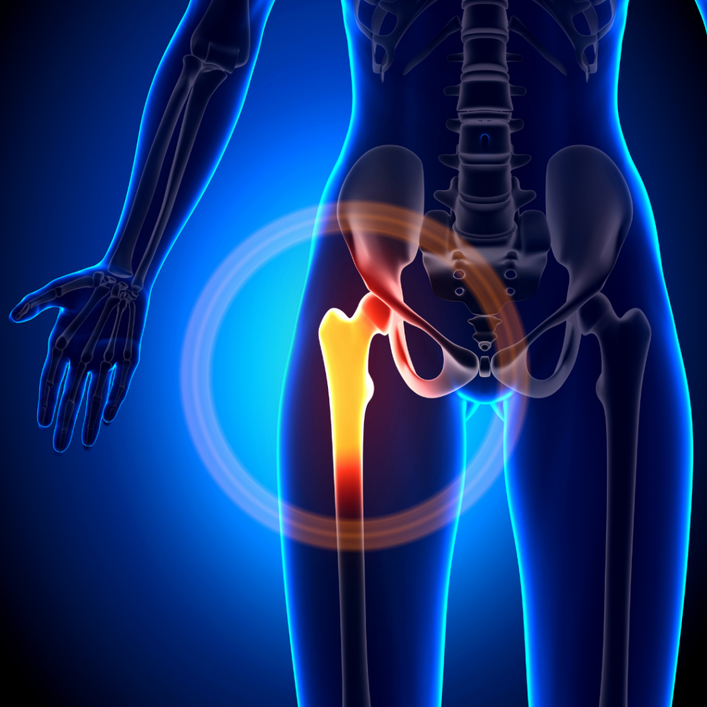 Lateral Hip Pain